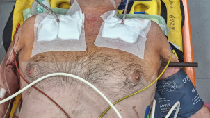 Muž se podruhé narodil. Kovová tyč mu probodla skrznaskrz hruď